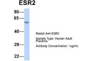 Host:  Rabbit  Target Name:  ESR2  Sample Type:  Human Adult Placenta  Antibody Dilution:  1. (ESR2 Antikörper  (N-Term))