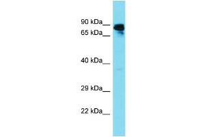 Host: Rabbit Target Name: GBP6 Sample Type: Fetal Liver lysates Antibody Dilution: 1. (GBP6 Antikörper  (N-Term))