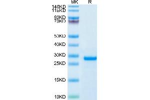 WFDC1 Protein (AA 32-220) (His tag)