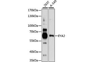 Western blot analysis of extracts of various cell lines, using EY antibody (ABIN7267072) at 1:1000 dilution. (EYA2 Antikörper  (AA 300-400))