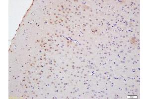 Formalin-fixed and paraffin embedded rat brain labeled with Anti-Myelin PLP Polyclonal Antibody, Unconjugated  at 1:200 followed by conjugation to the secondary antibody and DAB staining (PLP1 Antikörper  (AA 21-120))
