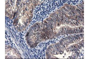 Image no. 8 for anti-F-Box Protein 21 (FBXO21) antibody (ABIN1498231) (FBXO21 Antikörper)