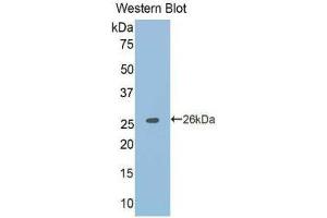 Western Blotting (WB) image for anti-Tumor Necrosis Factor Receptor Superfamily, Member 21 (TNFRSF21) (AA 406-605) antibody (ABIN1176216) (TNFRSF21 Antikörper  (AA 406-605))