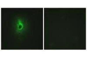Immunofluorescence analysis of HeLa cells, using Collagen VI α3 antibody. (COL6a3 Antikörper)