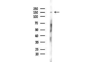 Western blot analysis of lysates from Hela cells(starvation 24h treatment), using Phospho-PERK (Thr982) Antibody at 1/1000 dilution.