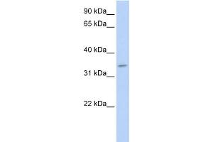 WB Suggested Anti-TNMD Antibody Titration:  0. (TNMD Antikörper  (N-Term))