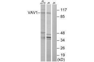 Western blot analysis of extracts from Jurkat cells, using VAV1 (Ab-174) antibody. (VAV1 Antikörper  (Tyr174))