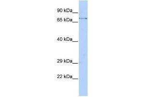 FBXW8 antibody used at 1 ug/ml to detect target protein. (FBXW8 Antikörper  (Middle Region))