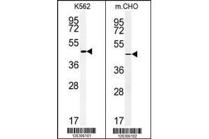 (LEFT)Western blot analysis of ENTPD8 Antibody in K562 cell line lysates (35ug/lane). (ENTPD8 Antikörper  (C-Term))
