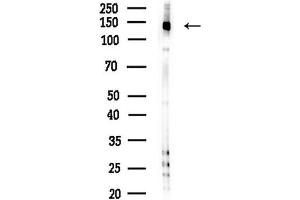 anti-tau Tubulin Kinase 2 (TTBK2) (C-Term) antibody
