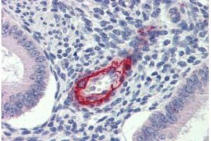 Uterus, Human: Formalin-Fixed, Paraffin-Embedded (FFPE) (DDAH2 Antikörper  (N-Term))