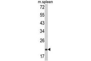 Western blot analysis of PSMA7 Antibody (Center) in mouse spleen tissue lysates (35ug/lane). (PSMA7 Antikörper  (Middle Region))