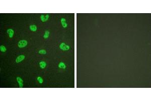 Forskolin + -Immunofluorescence analysis of HeLa cells, treated with Forskolin (40nM, 30mins), using DNA-PK antibody. (PRKDC Antikörper)