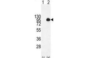 Western Blotting (WB) image for anti-Mucin 20, Cell Surface Associated (MUC20) antibody (ABIN2995265) (MUC20 Antikörper)