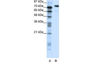 Western Blotting (WB) image for anti-SATB Homeobox 1 (SATB1) antibody (ABIN2461672) (SATB1 Antikörper)