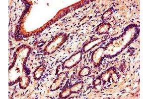 Immunohistochemistry of paraffin-embedded human pancreatic tissue using ABIN7151870 at dilution of 1:100 (EPH Receptor B6 Antikörper  (AA 410-553))