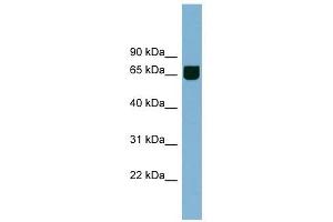 RIC8B antibody used at 1 ug/ml to detect target protein. (RIC8B Antikörper)
