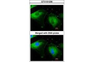 Image no. 3 for anti-Filamin B, beta (FLNB) (AA 30-239) antibody (ABIN467430) (FLNB Antikörper  (AA 30-239))