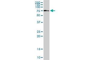CHEK2 MaxPab rabbit polyclonal antibody. (CHEK2 Antikörper  (AA 1-543))