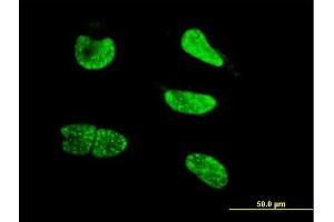 Immunofluorescence of monoclonal antibody to NEUROG3 on HeLa cell. (Neurogenin 3 Antikörper  (AA 1-101))