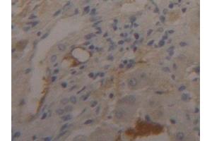 Detection of FGB in Human Liver Tissue using Polyclonal Antibody to Fibrinogen Beta Chain (FGB)