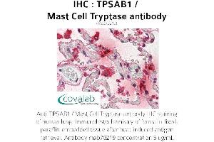 Image no. 1 for anti-Tryptase alpha/beta 1 (TPSAB1) antibody (ABIN1723158) (TPSAB1 Antikörper)
