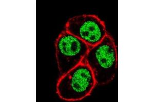 Confocal immunofluorescent analysis of CDC73 Antibody (Center) (ABIN653128 and ABIN2842707) with Hela cell followed by Alexa Fluor 488-conjugated goat anti-rabbit lgG (green). (HRPT2 Antikörper  (AA 132-161))