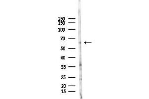 Western blot analysis of lysates from HUVEC cells(LPS 4h treatment), using ERVK-18 Antibody at 1/1000 dilution. (ERVK-18 Antikörper)