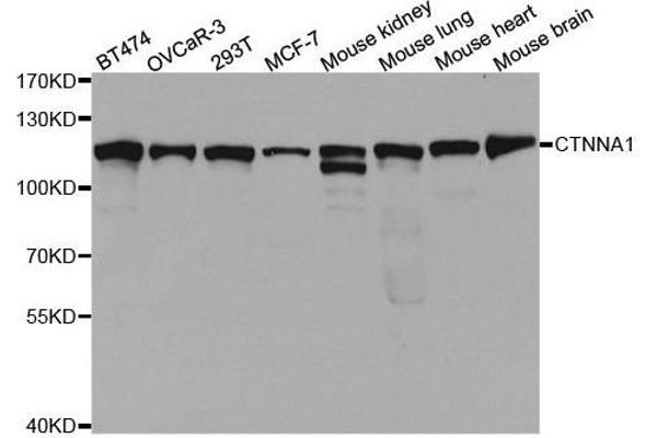CTNNA1 Antikörper  (AA 637-906)