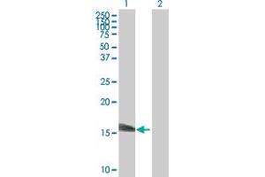 Western Blot analysis of SSNA1 expression in transfected 293T cell line by SSNA1 MaxPab polyclonal antibody. (SSNA1 Antikörper  (AA 1-119))