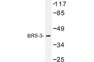 Image no. 1 for anti-Bombesin-Like Receptor 3 (BRS3) antibody (ABIN317729) (BRS3 Antikörper)