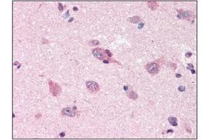 Immunohistochemistry (IHC) image for anti-Amyloid beta (A4) Precursor Protein (APP) (AA 18-289) antibody (ABIN317496) (APP Antikörper  (AA 18-289))