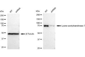 Western blotting analysis using Lysine acetyltransferase 7 antibody (ABIN7799528). (Rekombinanter MYST2 Antikörper)
