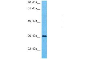 Host:  Rabbit  Target Name:  MFF  Sample Type:  Stomach Tumor lysates  Antibody Dilution:  1. (MFF Antikörper  (C-Term))