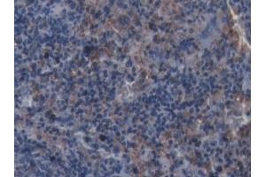 Immunohistochemistry (IHC) image for anti-Ionized Calcium-binding Adapter Molecule 1 (IBA1) (AA 1-147) antibody (ABIN7427558)