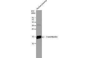 WB Image Human tissue extract (30 μg) was separated by 15% SDS-PAGE, and the membrane was blotted with Transthyretin antibody [N1C3] , diluted at 1:500.