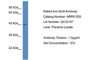 Western Blotting (WB) image for anti-Aspartylglucosaminidase (AGA) (Middle Region) antibody (ABIN2788660) (AGA Antikörper  (Middle Region))