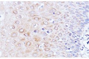Immunohistochemistry of paraffin-embedded Human esophageal using Polyclonal AntibodyPC1 Polyclonal Antibody at dilution of 1:100 (40x lens). (PC1 Antikörper)