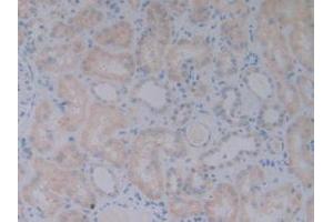 DAB staining on IHC-P; Samples: Human Kidney Tissue. (BMP10 Antikörper  (AA 315-424))