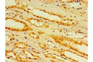Immunohistochemistry of paraffin-embedded human kidney tissue using ABIN7158862 at dilution of 1:100 (DCP2 Antikörper  (AA 1-385))