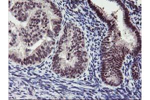 Image no. 4 for anti-Ankyrin Repeat Domain 53 (ANKRD53) (AA 1-300) antibody (ABIN1490719) (ANKRD53 Antikörper  (AA 1-300))