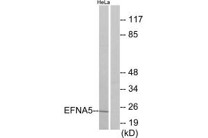Western blot analysis of extracts from HeLa cells, using EFNA5 antibody. (Ephrin A5 Antikörper  (Internal Region))