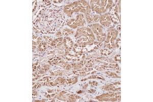 Immunohistochemical analysis of (ABIN391830 and ABIN2841673) on paraffin-embedded Human kidney tissue. (HSP70 1A Antikörper  (AA 19-48))