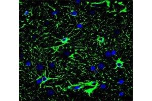 Confocal immunofluorescent analysis of GFAP antibody with brain tissue followed by Alexa Fluor 488-conjugated goat anti-mouse lgG (green). (GFAP Antikörper)