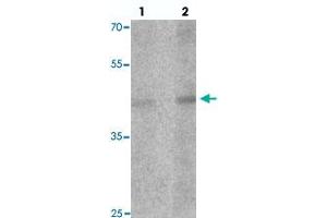 Western blot analysis of LMX1A in rat brain tissue with LMX1A polyclonal antibody  at (1) 1 and (2) 2 ug/mL. (LMX1A Antikörper  (C-Term))