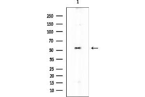 Western blot analysis of lysates from EC304 cells, using Chk2 Mouse Monoclonal Antibody at 1/1000 dilution.
