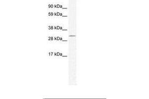 Image no. 1 for anti-Doublesex and Mab-3 Related Transcription Factor 2 (DMRT2) (AA 461-510) antibody (ABIN202258) (DMRT2 Antikörper  (AA 461-510))