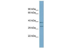 DPPA4 antibody used at 1 ug/ml to detect target protein. (DPPA4 Antikörper  (N-Term))