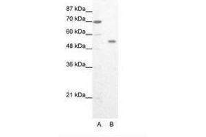 Image no. 1 for anti-Zinc Finger Protein 665 (ZNF665) (AA 76-125) antibody (ABIN202995) (ZNF665 Antikörper  (AA 76-125))