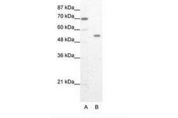 ZNF665 Antikörper  (AA 76-125)